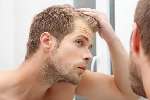 soluzioni per la calvizie