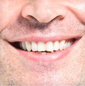 beautiful smile 2