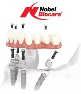 Nobel Biocare
