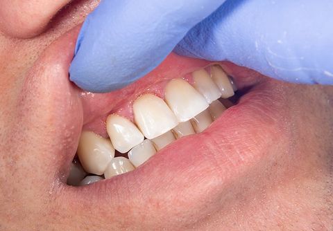 Checking the Teeth — Clarkston, MI — Mark Frenchi DDS Checking the Teeth — Clarkston, MI — Mark Frenchi DDS