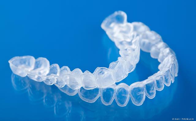 Home-Bleaching: Folien, in die das Bleaching-Gel eingefüllt wird und die anschließend über die Zähne gestülpt werden Home-Bleaching: Folien, in die das Bleaching-Gel eingefüllt wird und die anschließend über die Zähne gestülpt werden