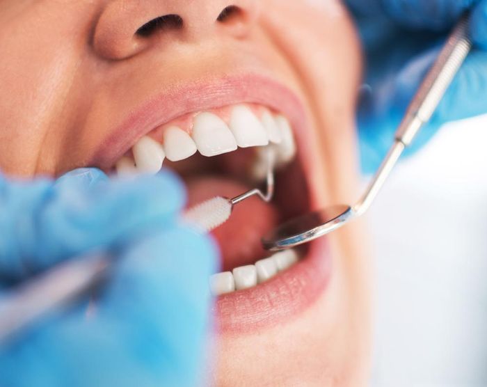 Dental Procedure — Alameda, CA — Alameda Family Dental Practice Dental Procedure — Alameda, CA — Alameda Family Dental Practice