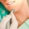 Sbiancamento dentale