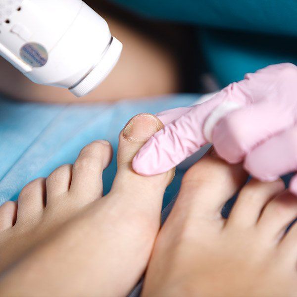 nail treatment