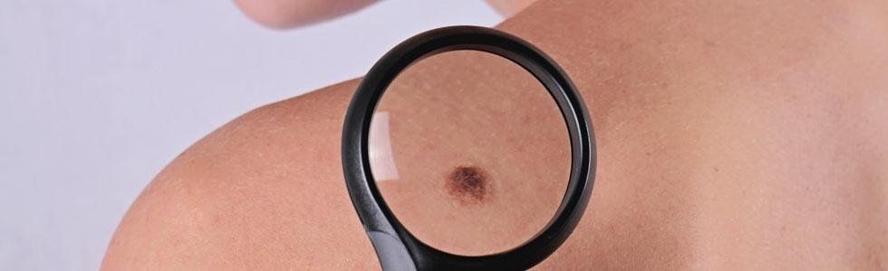 dermatologo