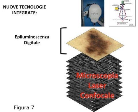 Esame microscopia laser confocale