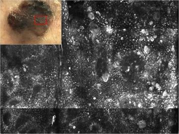 microscopia laser confocale