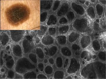 microscopia laser confocale