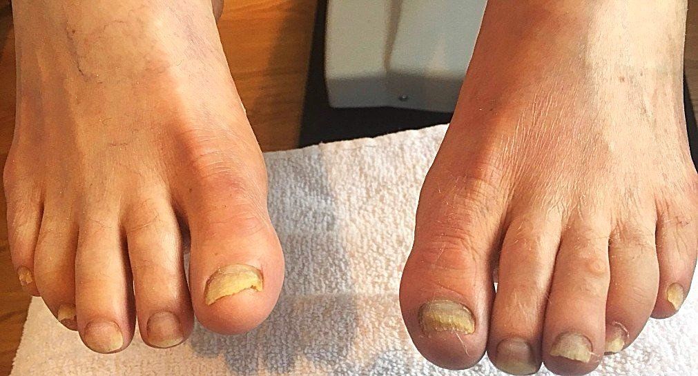 Clinic Fungus Treatment