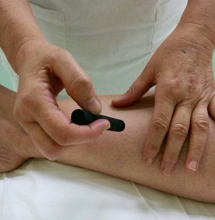 Trattamento di Moxicombustione