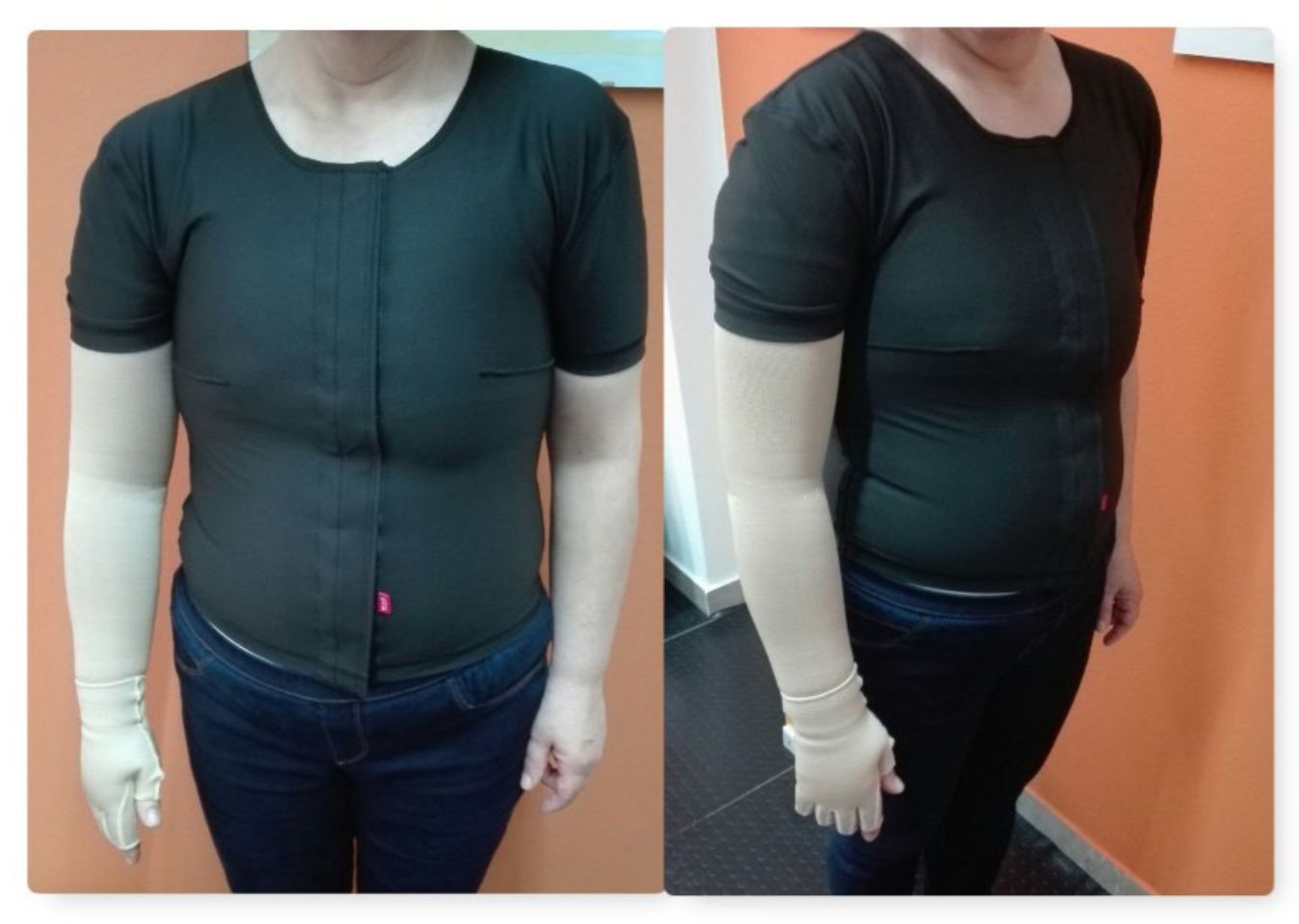 Maglia compressiva