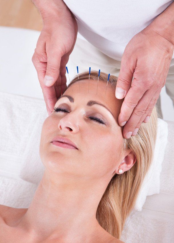 Beauty Acupuncture
