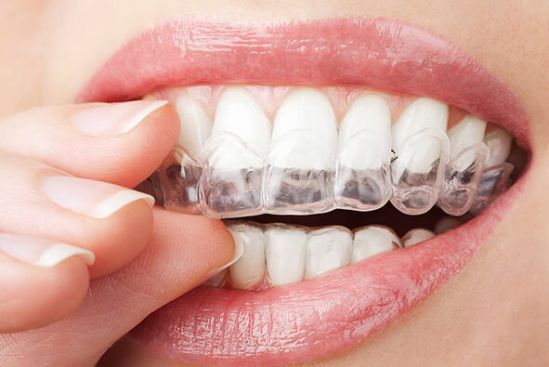 Orthodontics — Bristol, TN — McMillin & Christian Family Dentistry Orthodontics — Bristol, TN — McMillin & Christian Family Dentistry