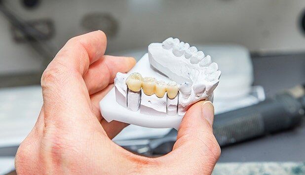 Dental Bridges — Bristol, TN — McMillin & Christian Family Dentistry Dental Bridges — Bristol, TN — McMillin & Christian Family Dentistry