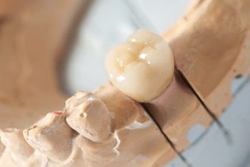 Dental Implants — Bristol, TN — McMillin & Christian Family Dentistry Dental Implants — Bristol, TN — McMillin & Christian Family Dentistry