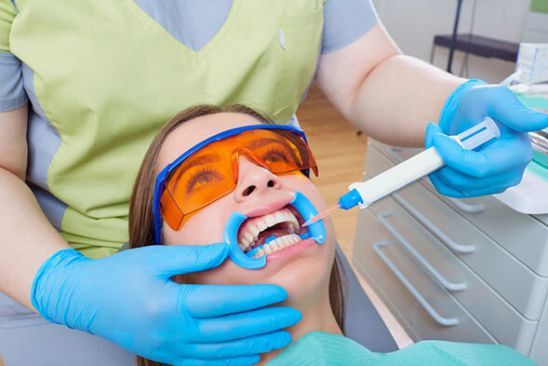 Dental Bleaching — Bristol, TN — McMillin & Christian Family Dentistry Dental Bleaching — Bristol, TN — McMillin & Christian Family Dentistry