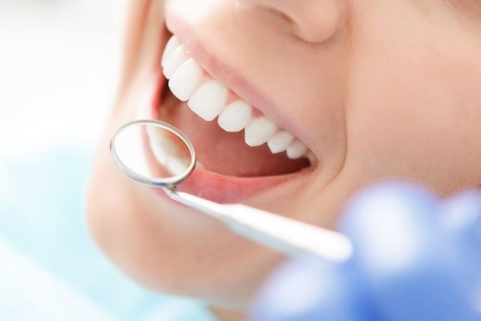 woman with white teeth
