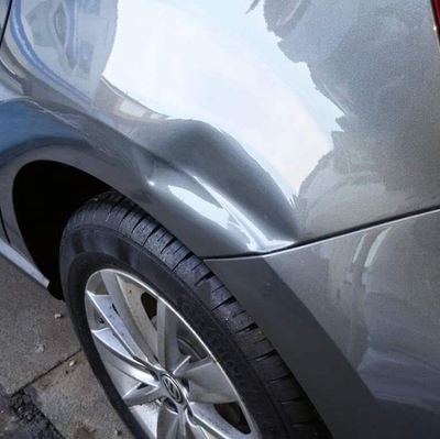 Dent removal