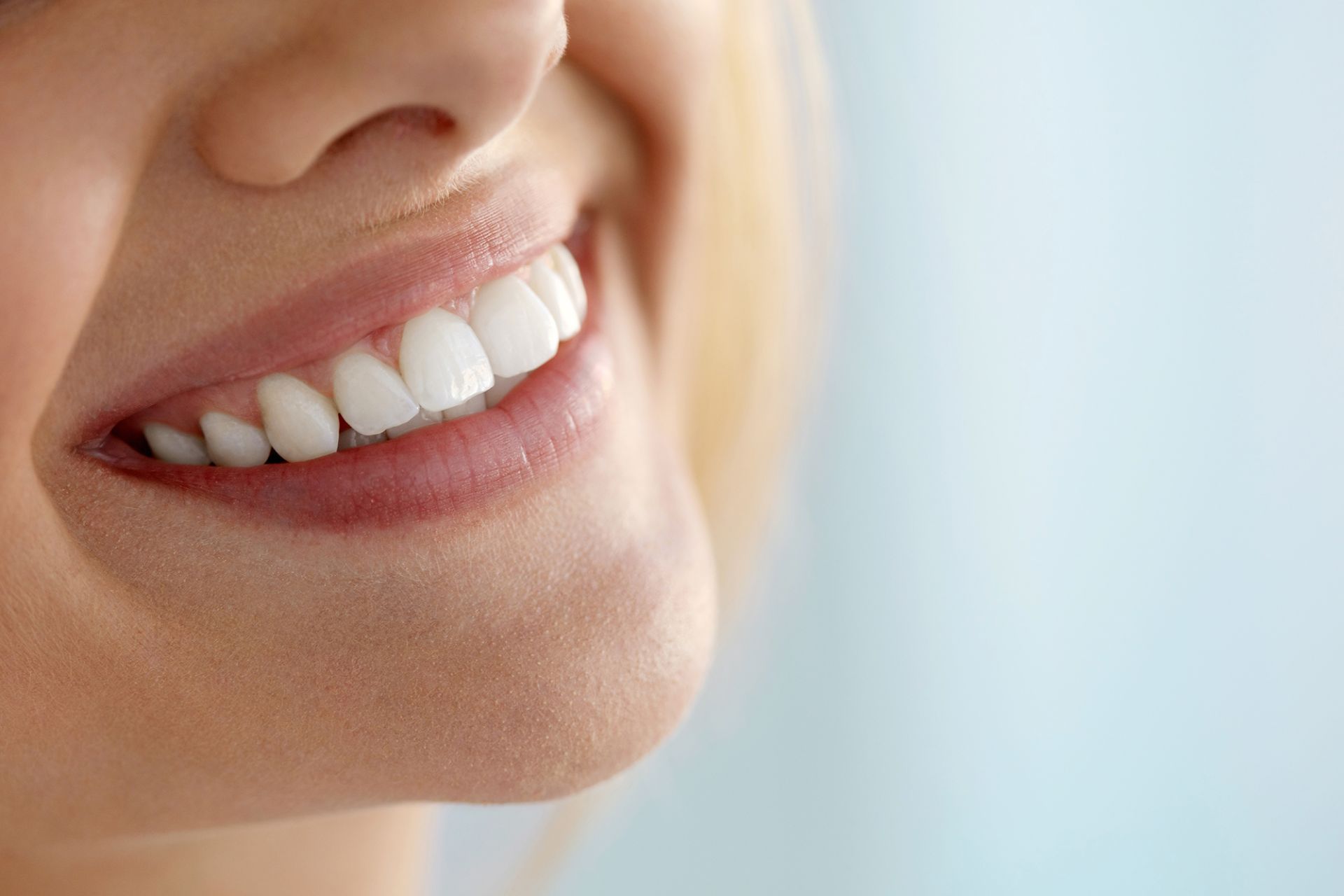 sbiancamento denti