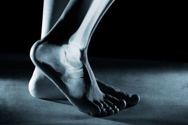 Ankle Joint - foot care in Mechanicsburg, PA Ankle Joint - foot care in Mechanicsburg, PA