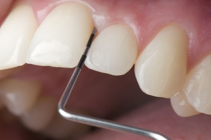 Pulizia dei denti