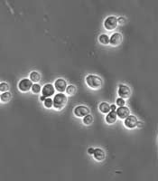 Yeast Infection Remedies - Dr. Louis Granirer Holistic Chiropractor. Yeast Infection Remedy in Kingston, Ulster County NY 12401