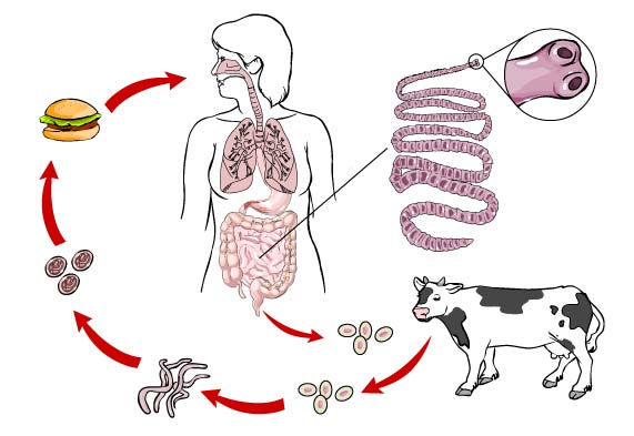 Natural Remedies for Parasite Cleansing