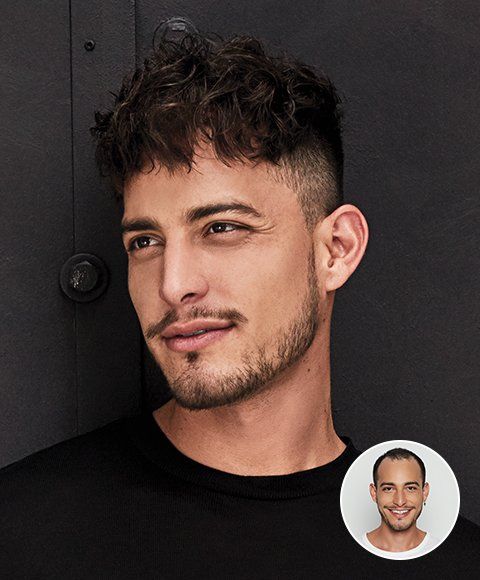 men's hair loss treatment