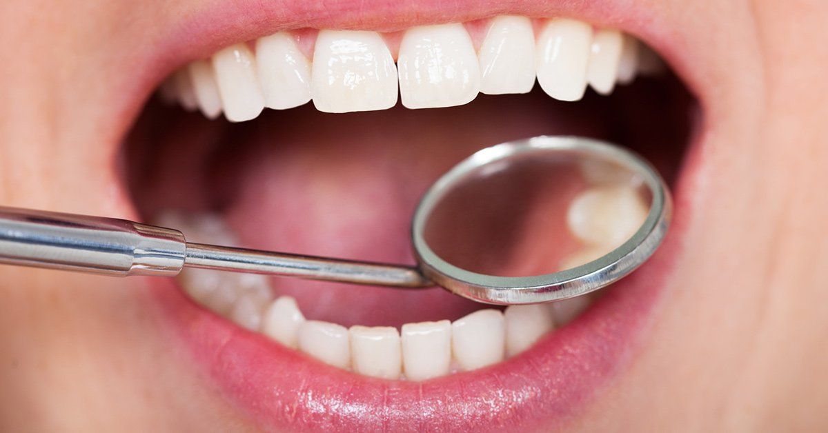 A close up of a person 's mouth with a dental mirror in it.