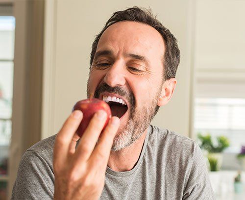 A man is eating an apple with his mouth open.