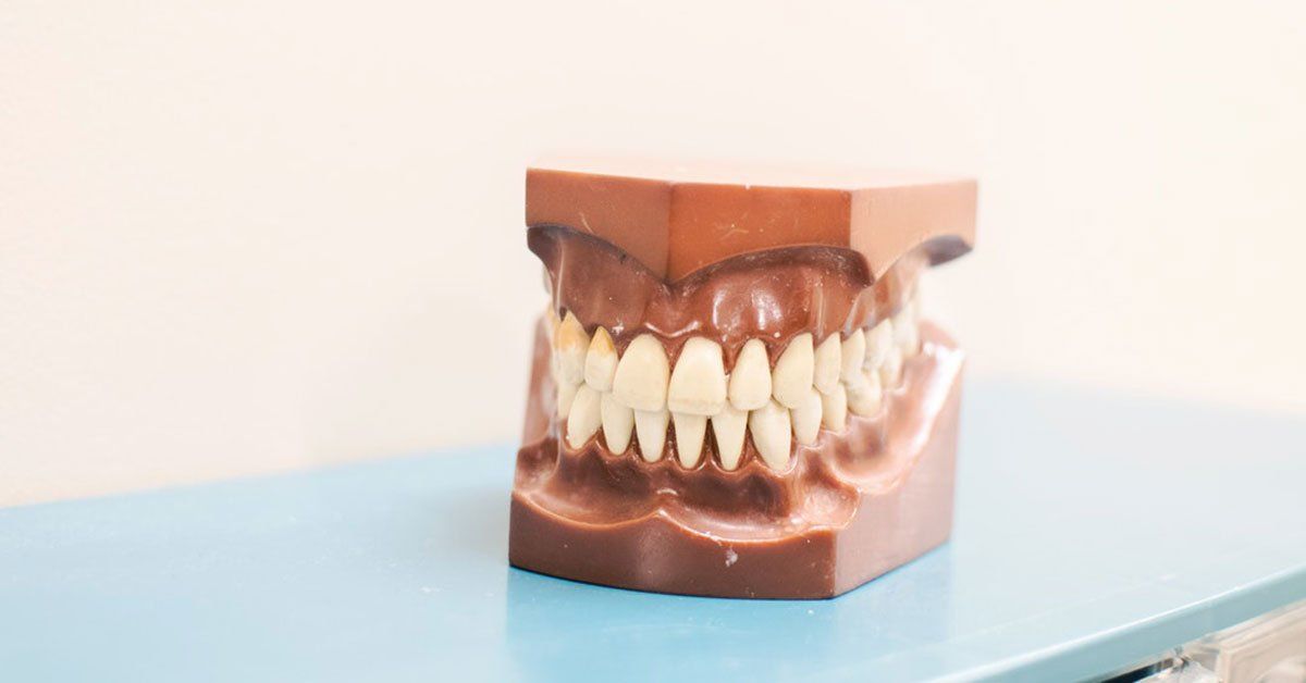 A model of a person 's teeth is sitting on a blue table.