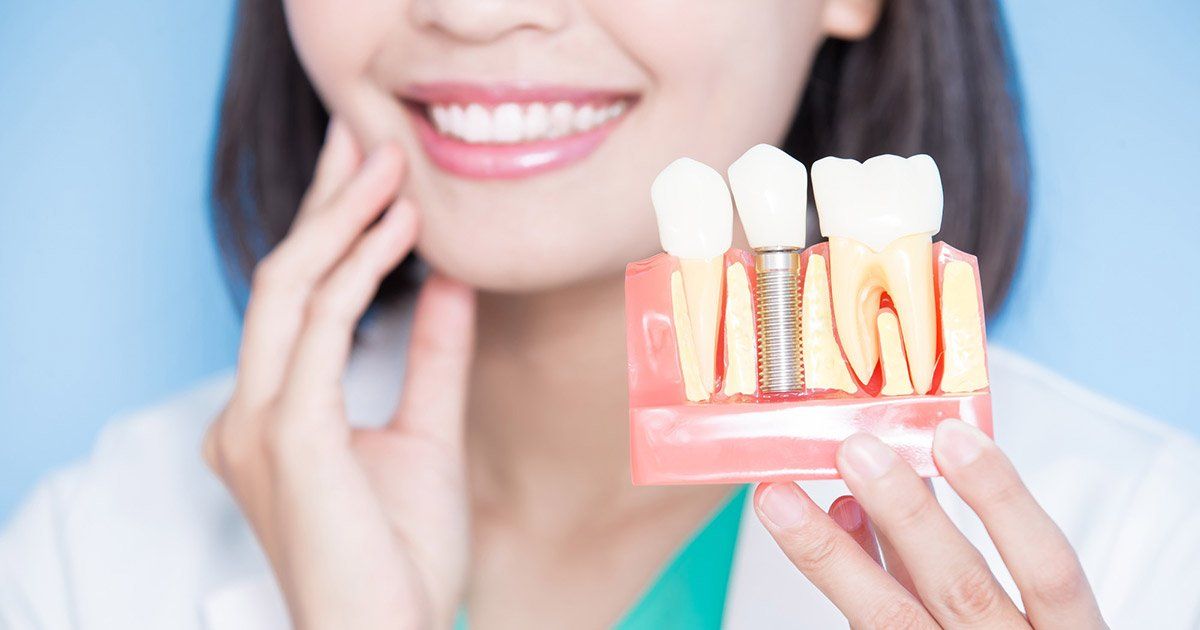 A woman is holding a model of dental implants in front of her mouth.
