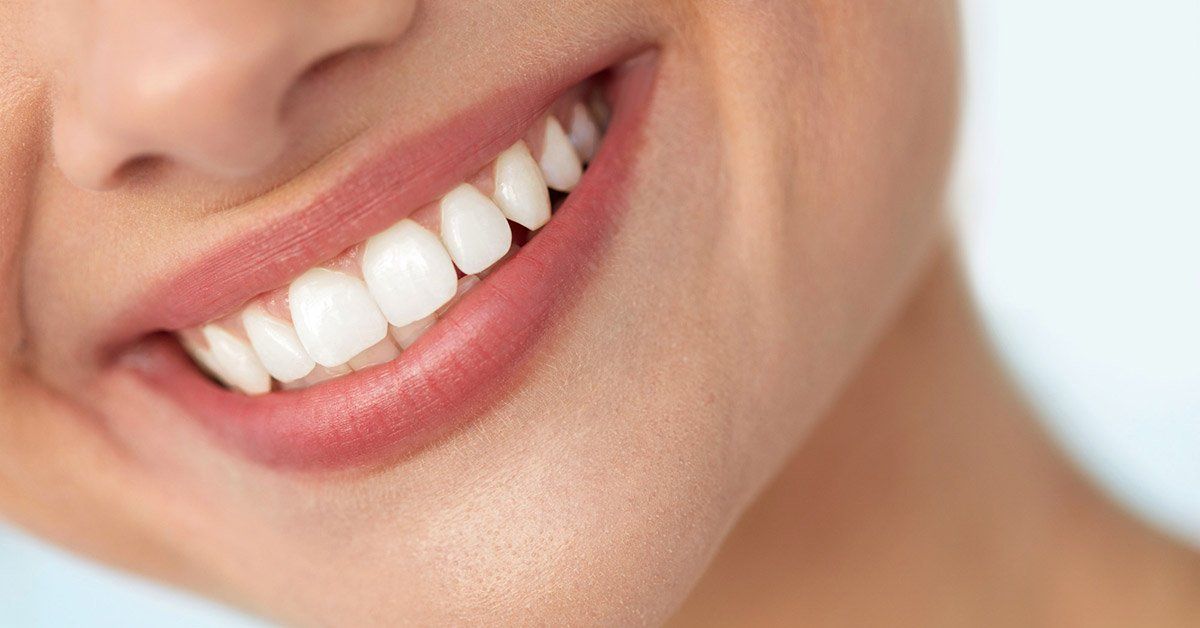 A close up of a woman 's smile with white teeth