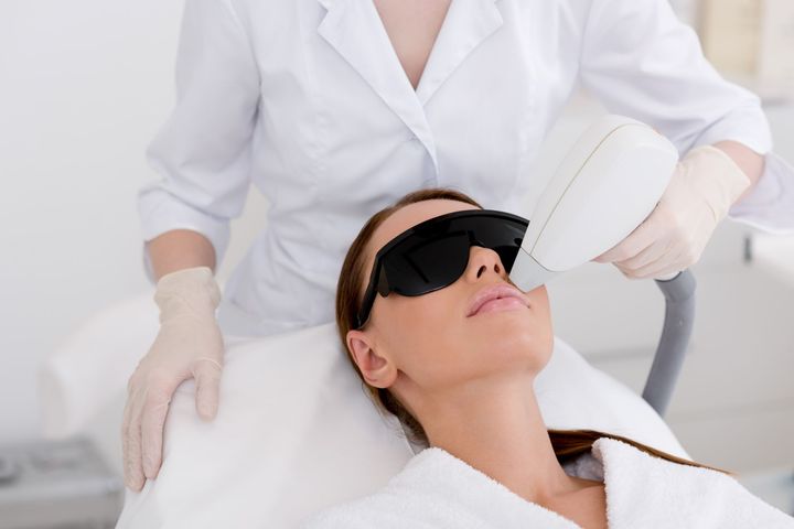 epilazione viso con laser a diodo