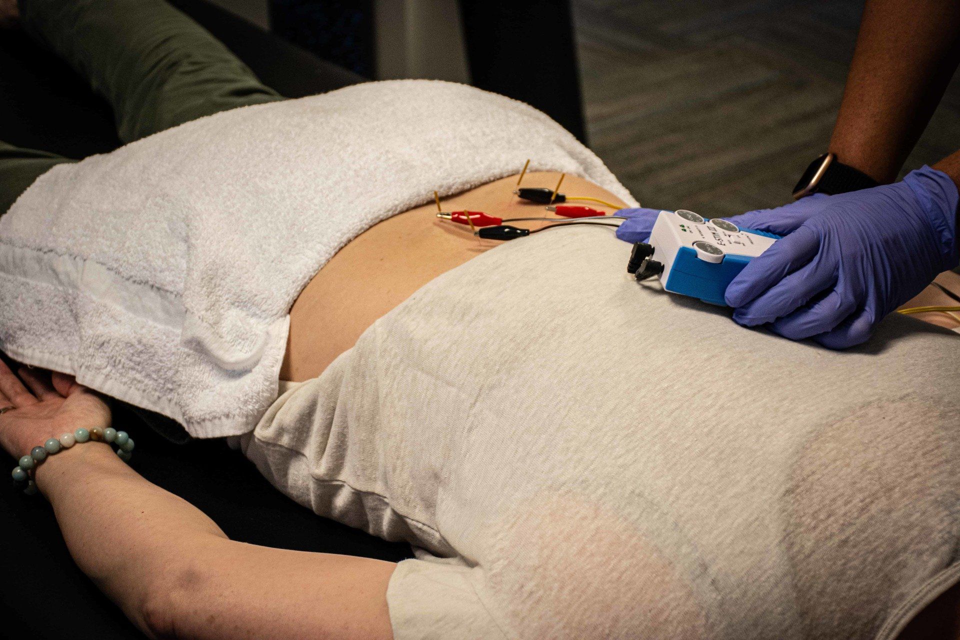 A woman is laying on a table with a towel on her stomach recieving dry needling