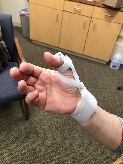 Wrist — Splint on an Injured Wrist in Homewood, IL Wrist — Splint on an Injured Wrist in Homewood, IL