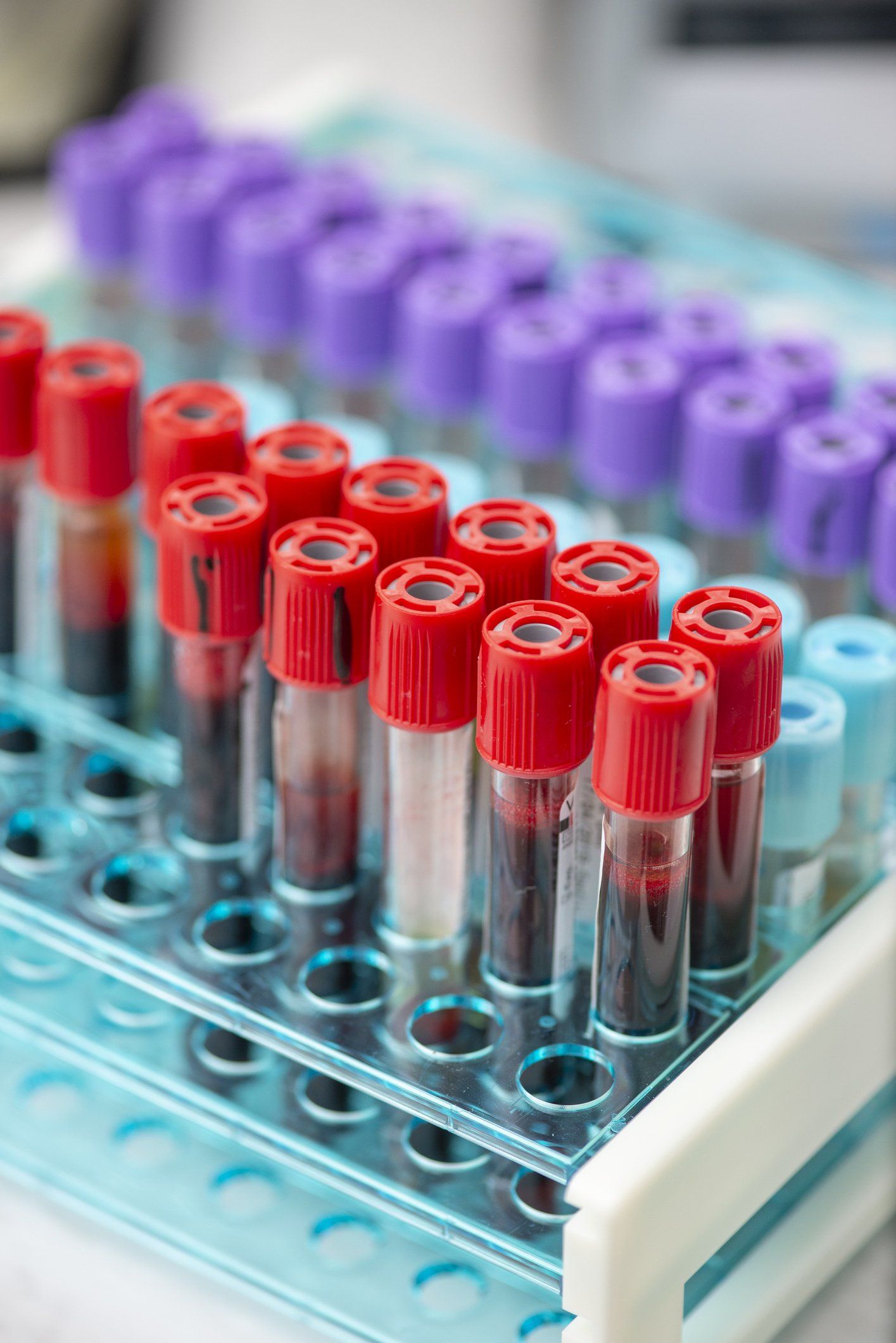 Tubes of Blood Sample — St. Clair Shores, MI — Eastlake Cardiovascular, P.C.