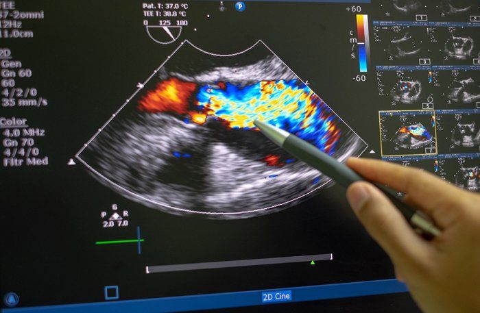 Echocardiography — St. Clair Shores, MI — Eastlake Cardiovascular, P.C.