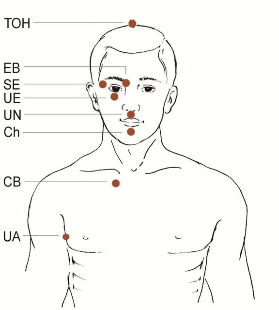 Annotated head-and-shoulders diagram with labeled facial and chest acupuncture points