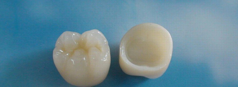 Learn about dental crowns and what they are used for. Image of dental crowns - What is a dental crown - explained by our family dentist in Lawrence KS 66049