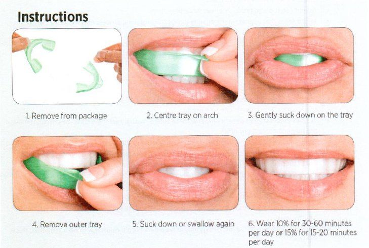 Instructions for using a green dental tray: placing, sucking, and wearing the tray.