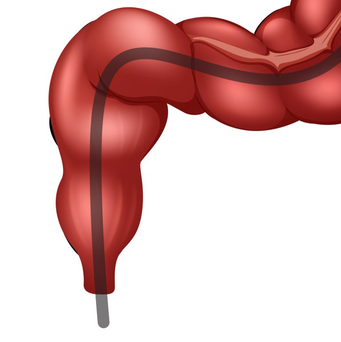 Red colon with an endoscopy tube inserted.