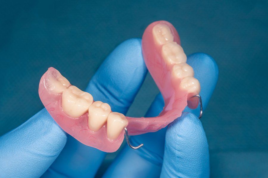 Upper Jaw Denture — Louisville, OH — Louisville Dental Clinic Upper Jaw Denture — Louisville, OH — Louisville Dental Clinic