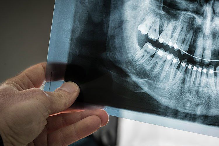 X-Rays