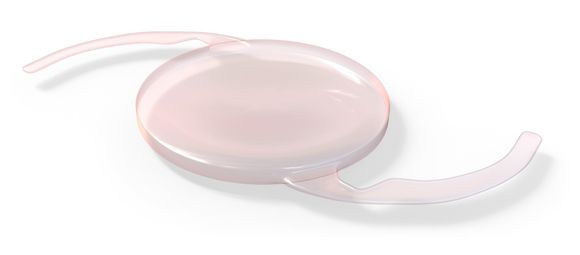 Impianto lenti intraoculari