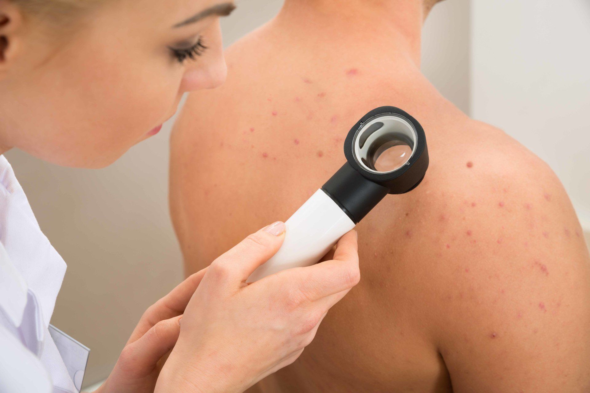 doctor looking at hives