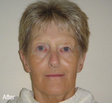 A close up of a woman 's face with the caption after