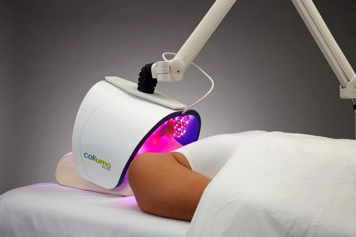 noninvasive facelist by Jennie Chew of Essence of Healing Acupuncture in Chafford Hundred