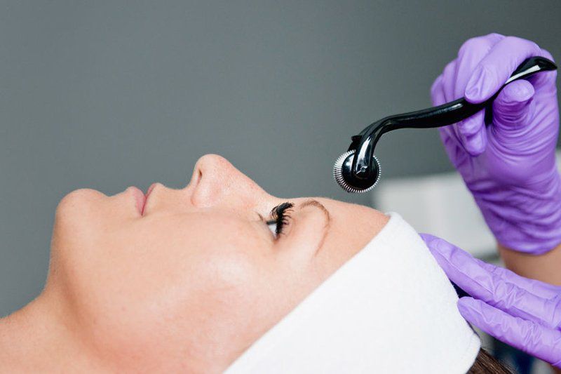 Derma Rolling by Jennie Chews Essence of Healing in Grays, Thurrock