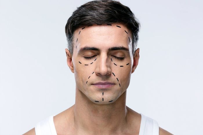 noninvasive facelist by Jennie Chew of Essence of Healing Acupuncture in Chafford Hundred